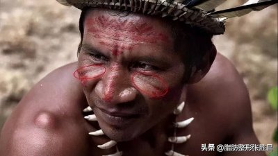 ​还有PS都修不掉的皱纹？面部有一种神奇的纹路叫作“印第安纹”